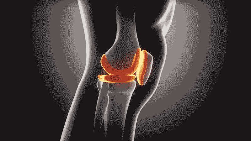 膝关节软骨再生3D动画图像