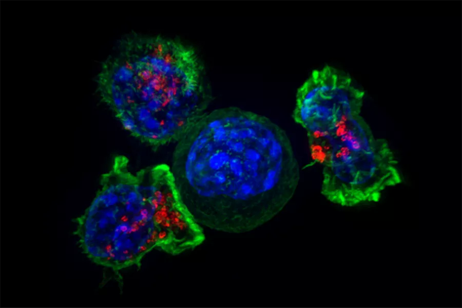 杀伤性T细胞图像 Image of Killer-T cells